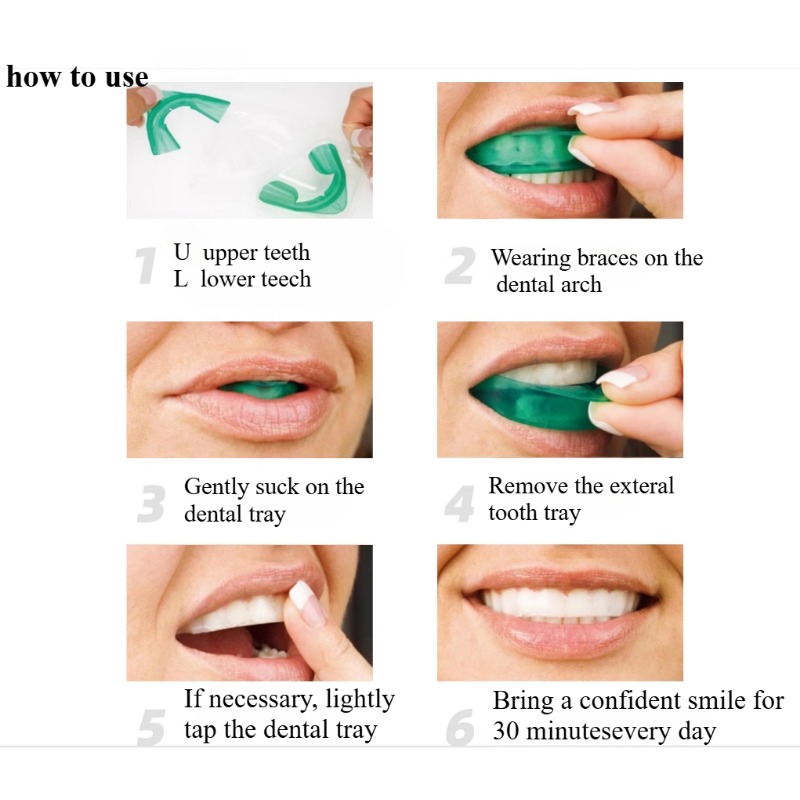 Set Vassoio per sbiancamento d - Teeth Whitening With Trays recensione e prezzo