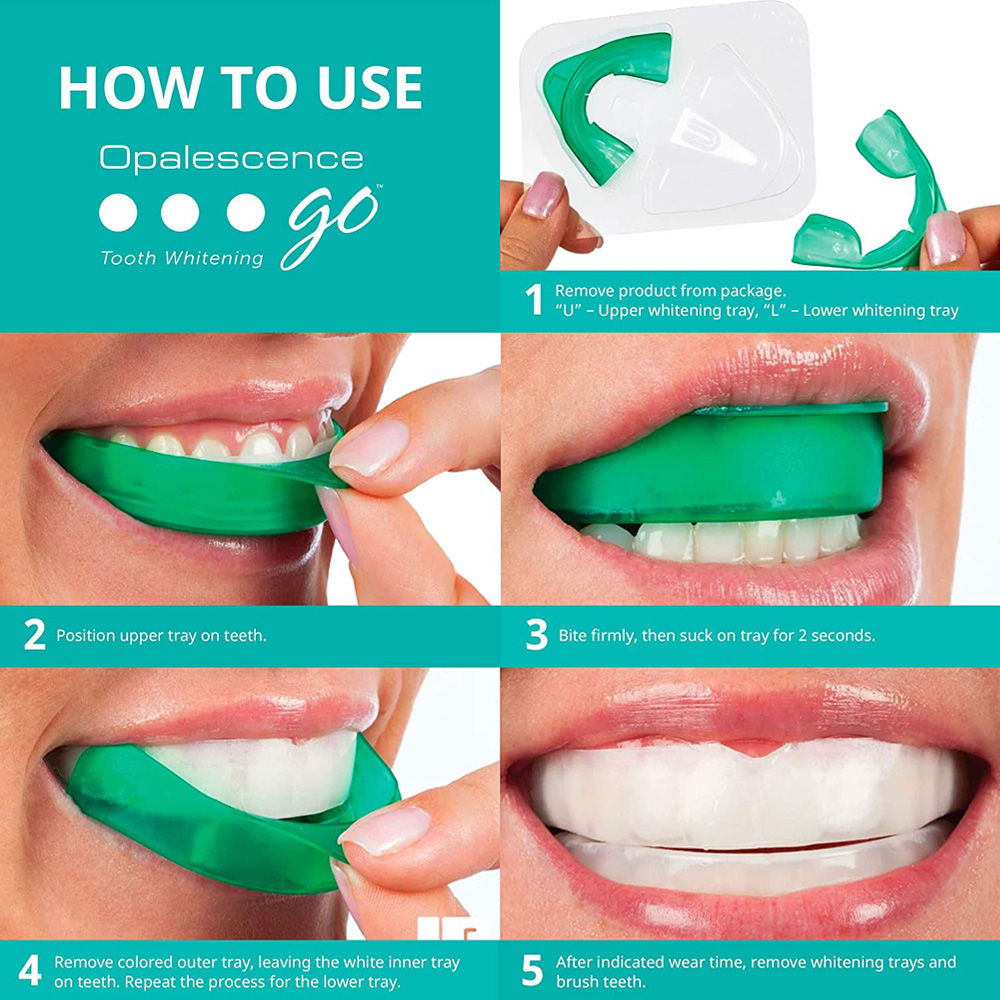 Perossido di idrogeno per sbia - Teeth Whitening With Trays recensione e prezzo
