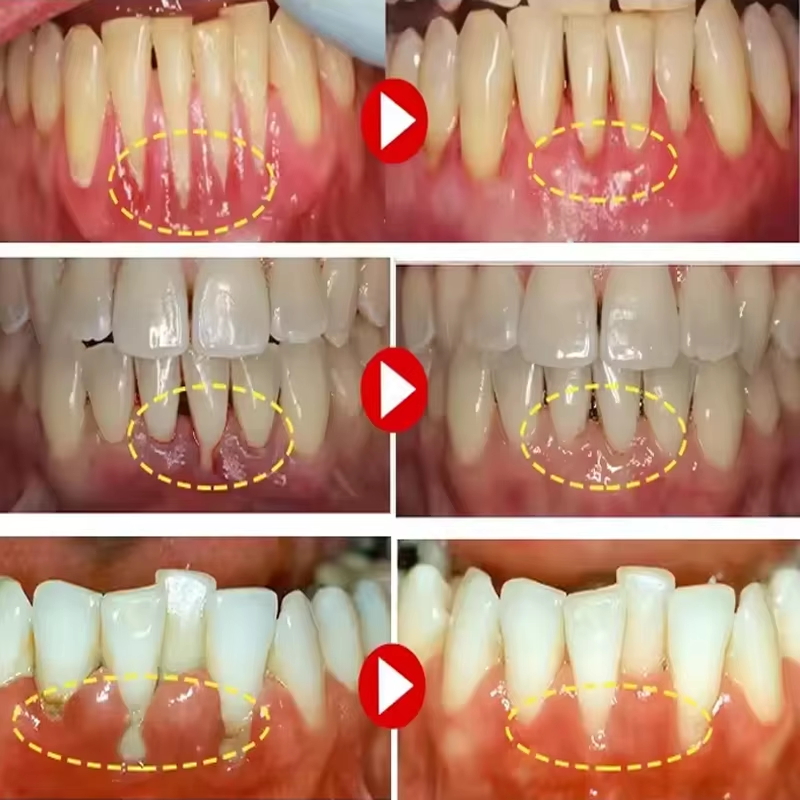 Gel Sbiancante per Denti e Rip - Teeth Whitening Gel recensione e prezzo
