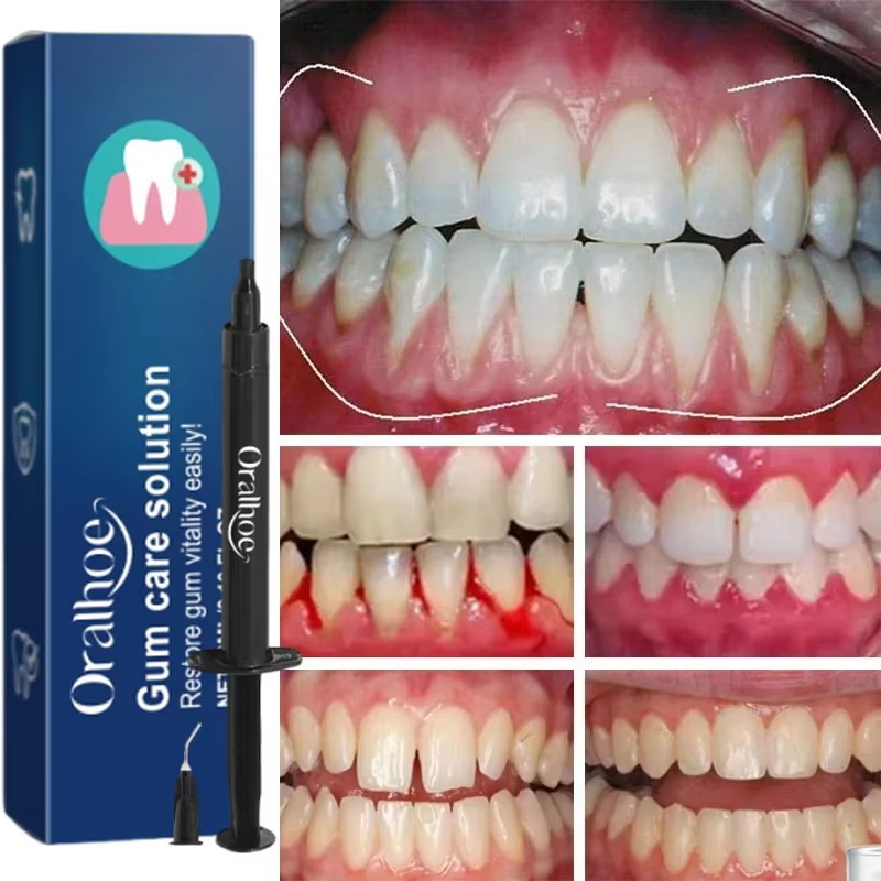 Gel Sbiancante per Denti e Rip - Teeth Whitening Gel recensione e prezzo