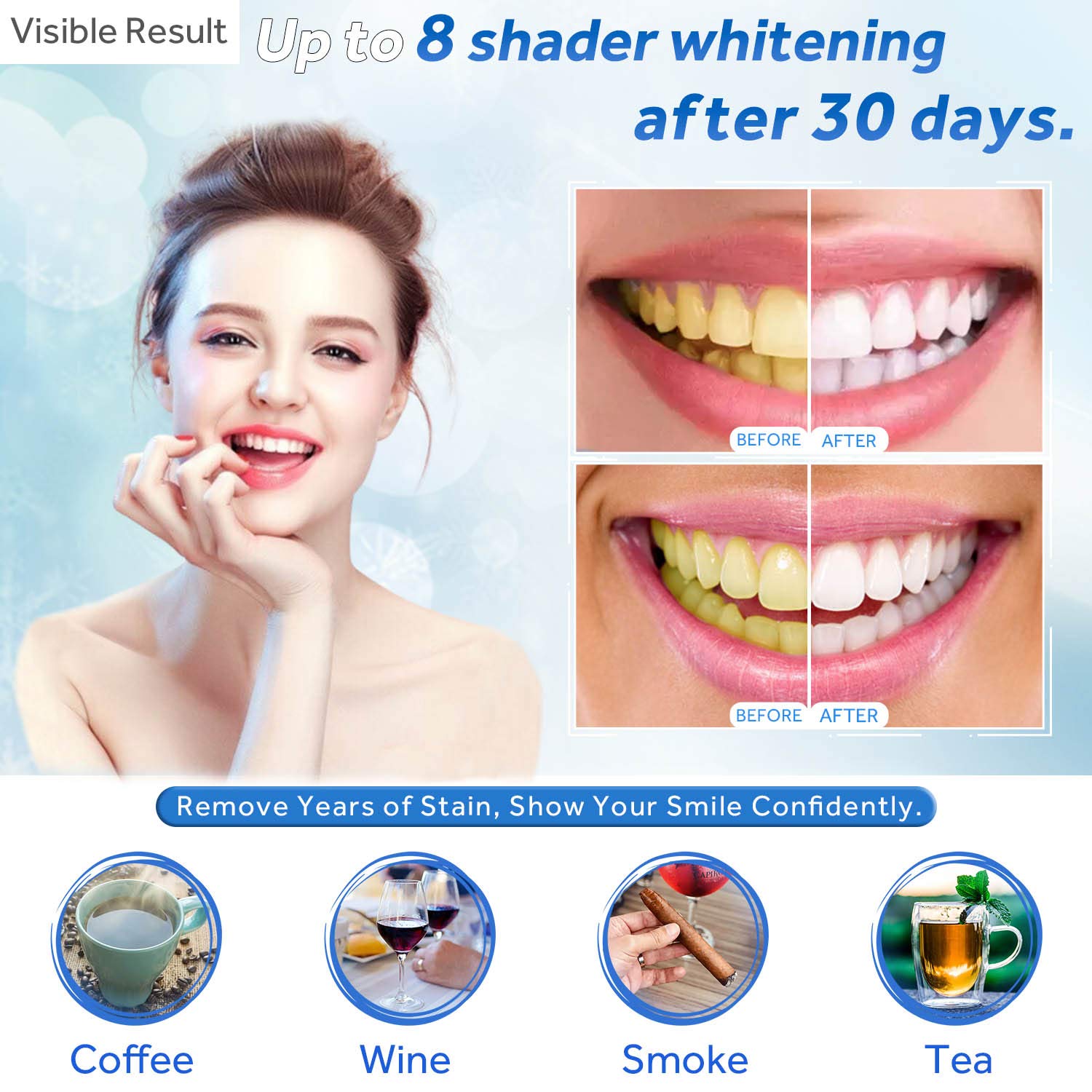 Gel sbiancante per denti Ricar - Teeth Whitening With Trays recensione e prezzo