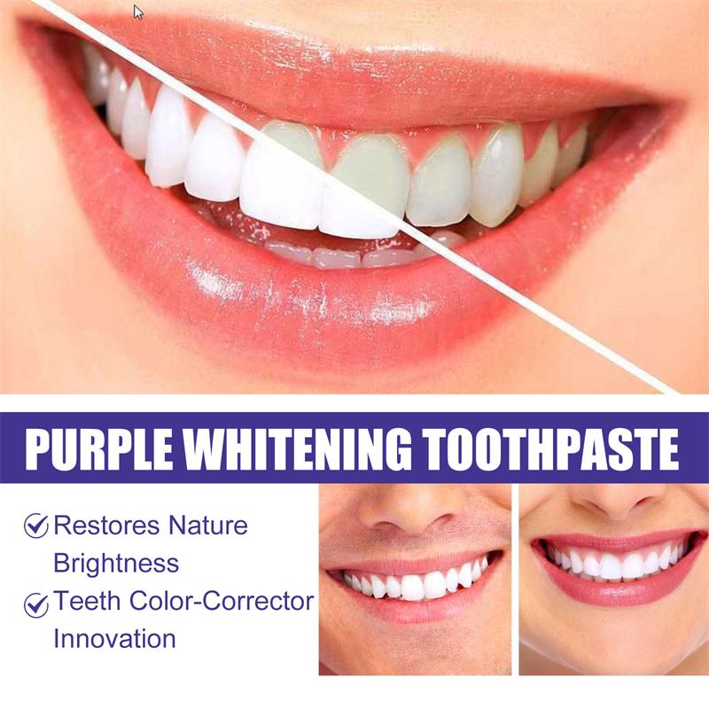 Dentifricio sbiancante 9D viol - Teeth Whitening Natural recensione e prezzo