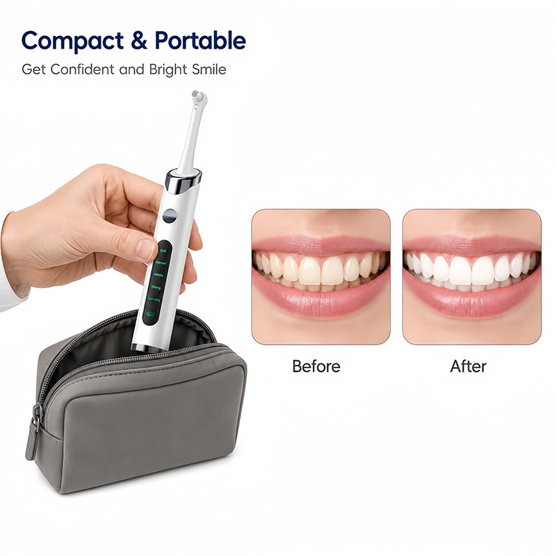 Kit Lucidatore per Denti per P - Teeth Whitening Light Kit recensione e prezzo