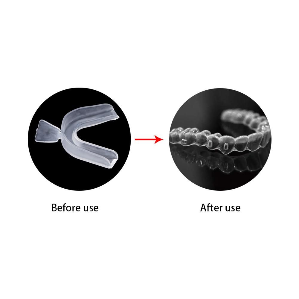 Protezione Bruxismo Coperture  - Teeth Whitening With Trays recensione e prezzo